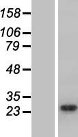 ARHGDIG Human Over-expression Lysate