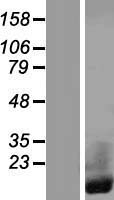 CRIP1 Human Over-expression Lysate