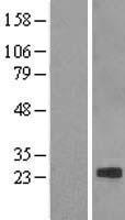 Claudin 7 (CLDN7) Human Over-expression Lysate