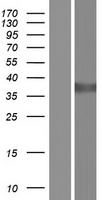 AKR1C1 Human Over-expression Lysate