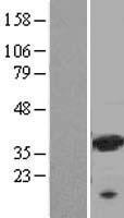 galectin 9 (LGALS9) Human Over-expression Lysate