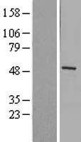 MMP1 Human Over-expression Lysate