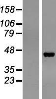 Pepsinogen II (PGC) Human Over-expression Lysate