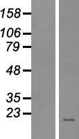 MCH (PMCH) Human Over-expression Lysate