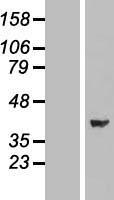 ERK2 (MAPK1) Human Over-expression Lysate