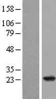 RAP2B Human Over-expression Lysate