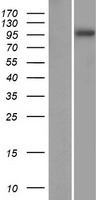 SPAG1 Human Over-expression Lysate