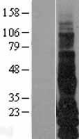 TGF alpha (TGFA) Human Over-expression Lysate