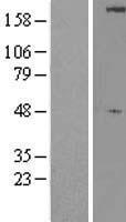ULK1 Human Over-expression Lysate