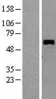 FKLF / KLF11 (KLF11) Human Over-expression Lysate