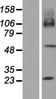 SLC7A7 Human Over-expression Lysate