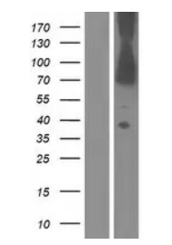 Dystrophin (DMD) Human Over-expression Lysate