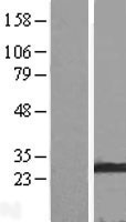 Membrin (GOSR2) Human Over-expression Lysate