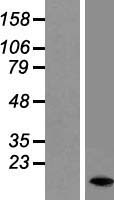 DAP1 (DAP) Human Over-expression Lysate