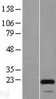MOCS2 Human Over-expression Lysate
