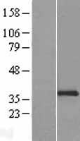 NCR1 Human Over-expression Lysate