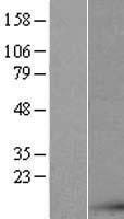 AKAP7 Human Over-expression Lysate