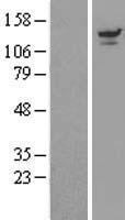 USP8 Human Over-expression Lysate