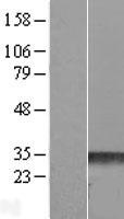 RND3 Human Over-expression Lysate
