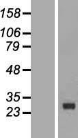 CDKN3 Human Over-expression Lysate