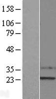 SSX1 Human Over-expression Lysate