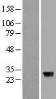 ZFAND5 Human Over-expression Lysate