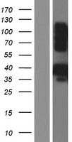 Iduronate 2 sulfatase (IDS) Human Over-expression Lysate