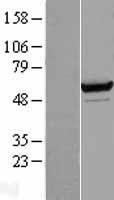Seryl tRNA synthetase (SARS) Human Over-expression Lysate
