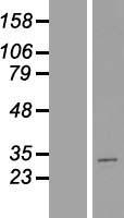 MTX2 Human Over-expression Lysate