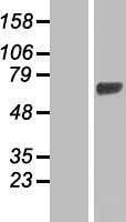 HBS1L Human Over-expression Lysate
