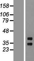 SHOX2 Human Over-expression Lysate