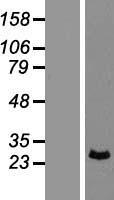 PRRX1 Human Over-expression Lysate