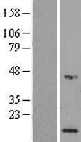 Selenophosphate synthetase 1 (SEPHS1) Human Over-expression Lysate