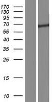 beta TRCP2 (FBXW11) Human Over-expression Lysate