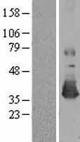 Methionine Sulfoxide Reductase A (MSRA) Human Over-expression Lysate