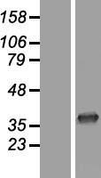 CNOT7 Human Over-expression Lysate