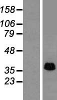 STOML2 Human Over-expression Lysate