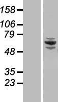 CCDC22 Human Over-expression Lysate