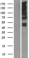 PGAP2 Human Over-expression Lysate