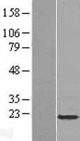 APOBEC3C Human Over-expression Lysate