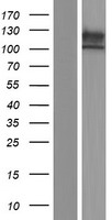 ECE2 (EEF1AKMT4) Human Over-expression Lysate