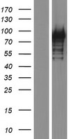 TSC22D2 Human Over-expression Lysate