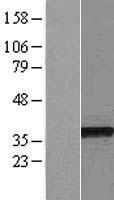 NSL1 Human Over-expression Lysate