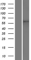 TMEM87A Human Over-expression Lysate