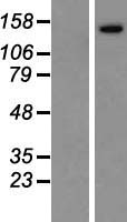 IBTK Human Over-expression Lysate