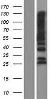 PTPN20B (PTPN20) Human Over-expression Lysate