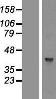 GTPBP5 (MTG2) Human Over-expression Lysate