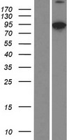 VILL Human Over-expression Lysate