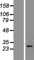 Protease Inhibitor 15 (PI15) Human Over-expression Lysate