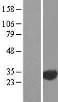 EXOSC3 Human Over-expression Lysate